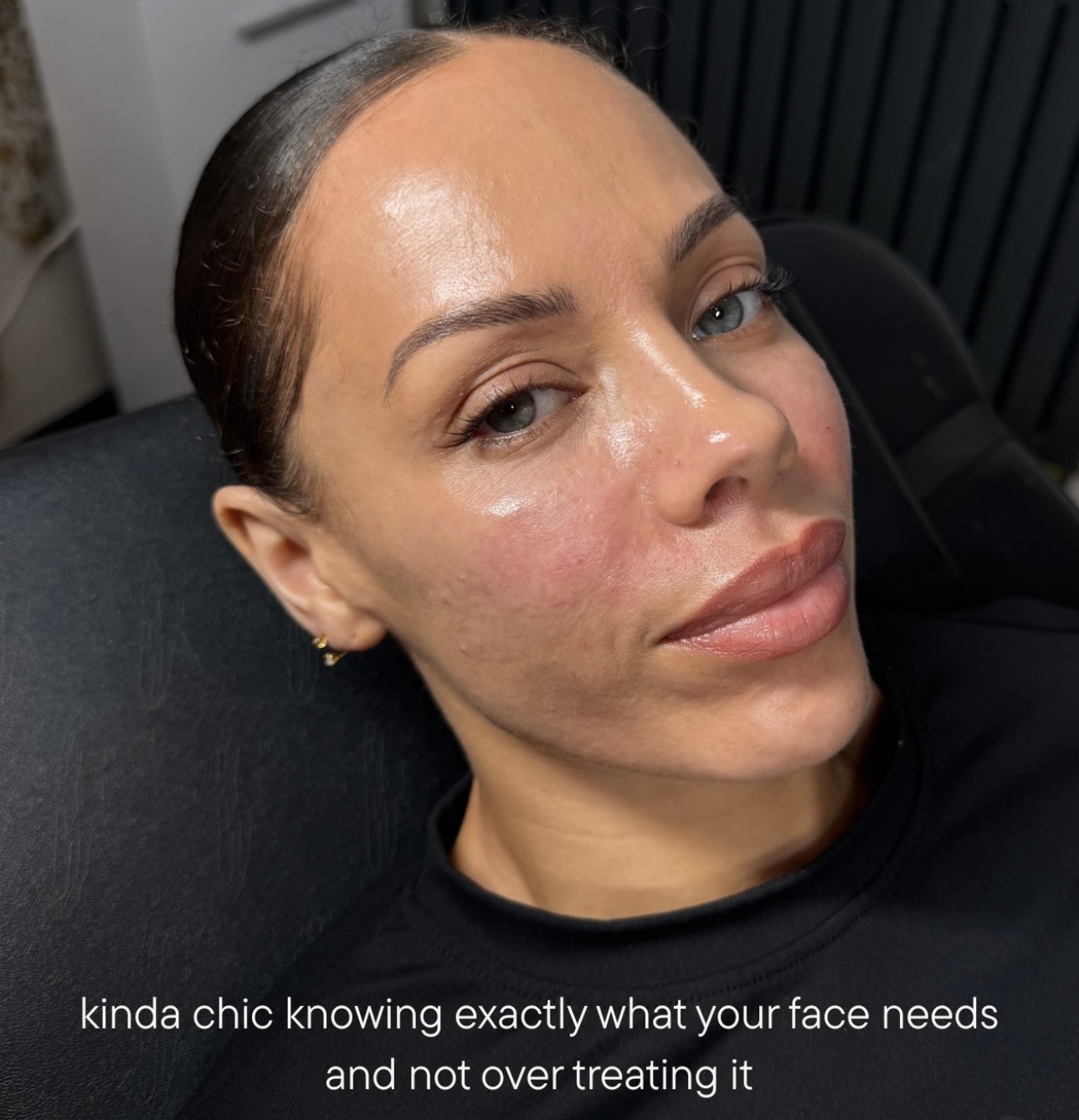 There’s something very chic about looking like the best version of yourself… without looking like you’ve had something done.