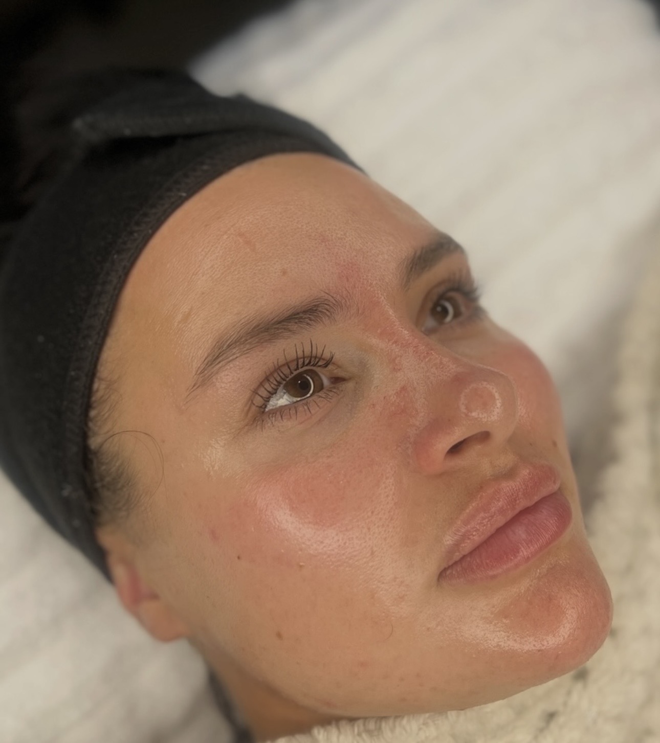 Your skin after one of our Copper Peptide facials 🩵 Glowing & Fresh 🩵