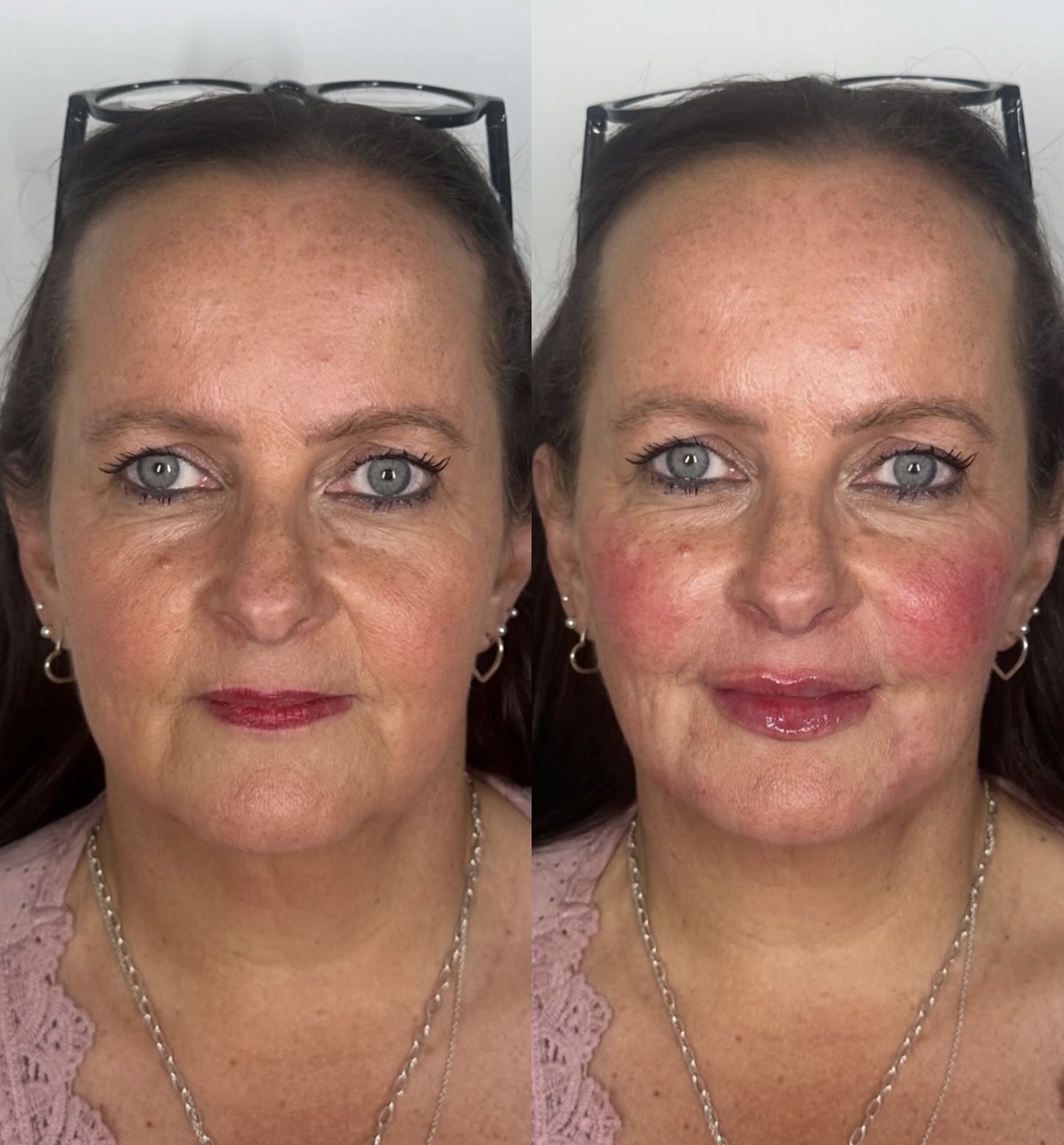 Golden Symmetry Consultation- Our gorgeous client's first client has lost a significant amount of weight and has lost conf…