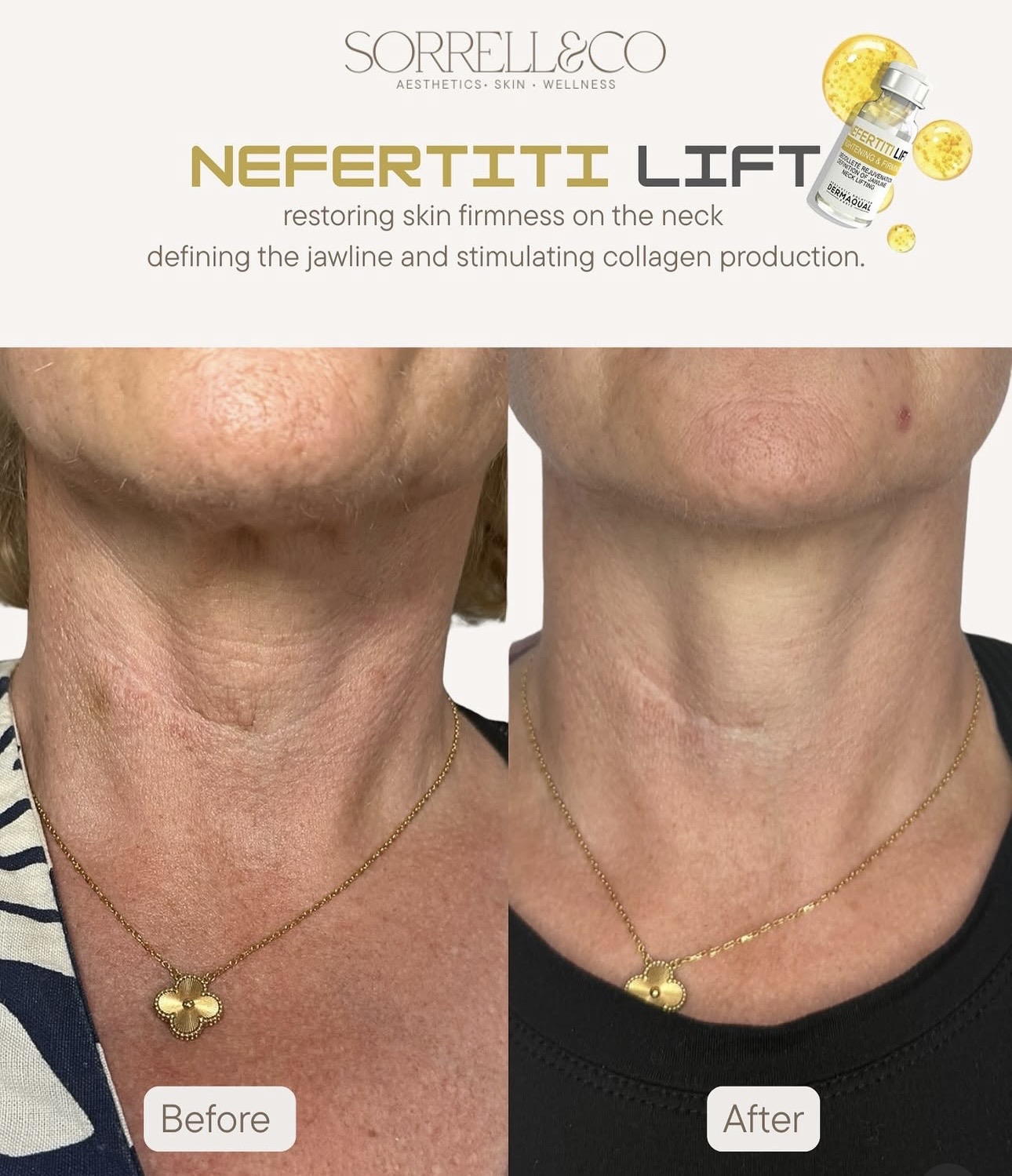 ✨ The neck is one of the first areas to show our age… but it’s also one of the most overlooked.