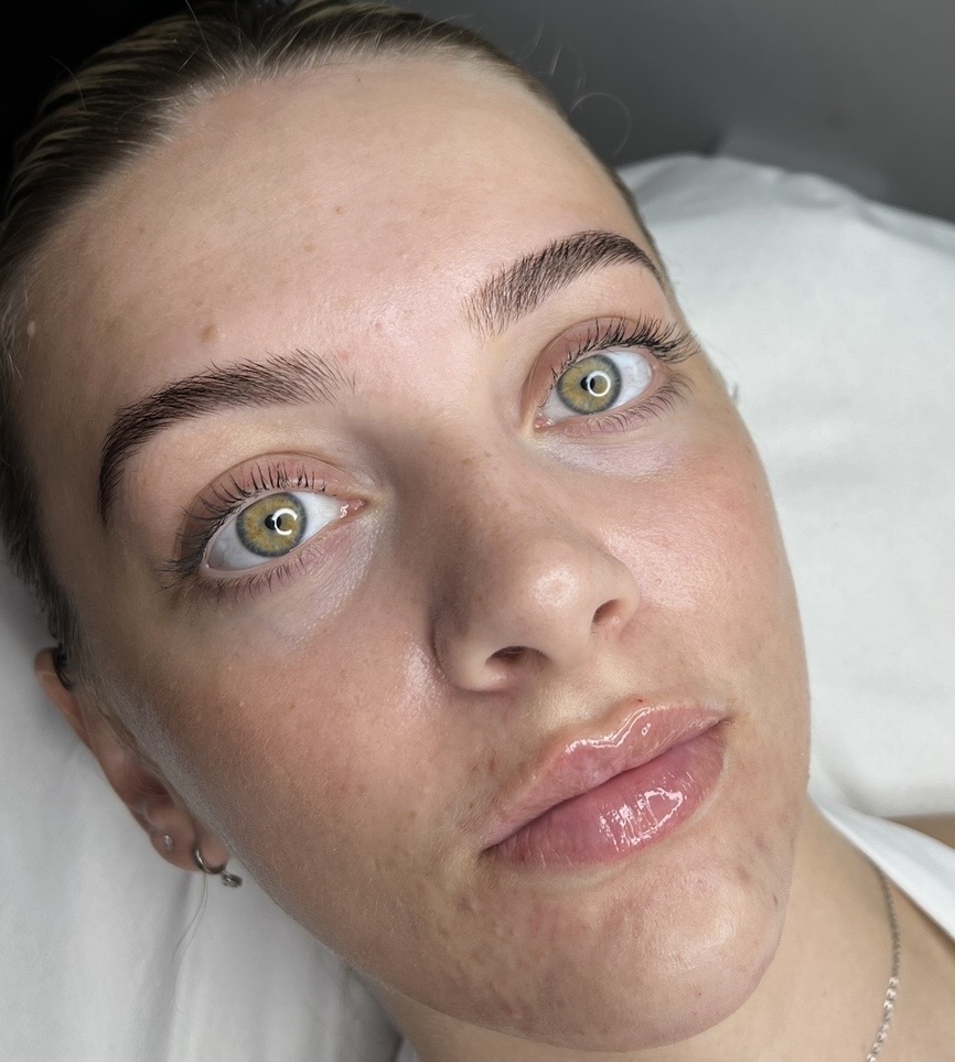 Natural Lips no problem ☁️ Every treatment we do will suit your facial ratio
