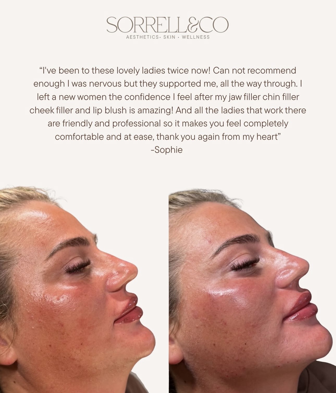 We absolutely LOVE reading your reviews 🤎 Hearing about your experience, your results and how you’ve felt throughout your…